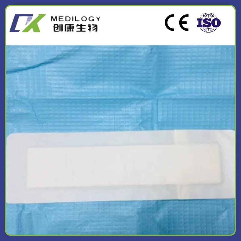 15X15cmmedical Disposable Sterile Self-Adhesive Non Woven Alginate Wound Dressing