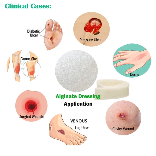 Wound Care Disposable Medical Products 10X10cm Alginate Dressing